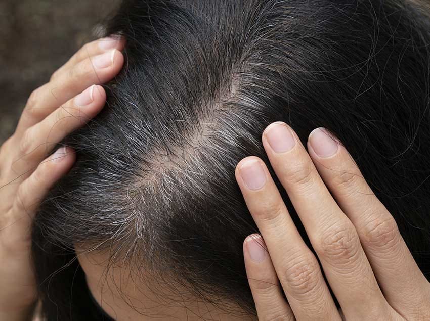 How Do You Hide Gray Roots Between Colorings?